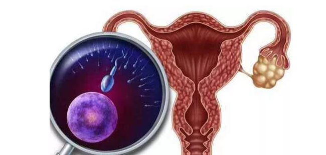 警惕！子宫肌瘤可能女性健康带来巨大隐患